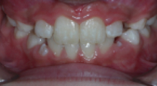 dental images 11421